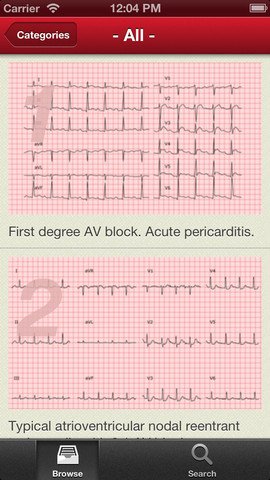 ECG Collection